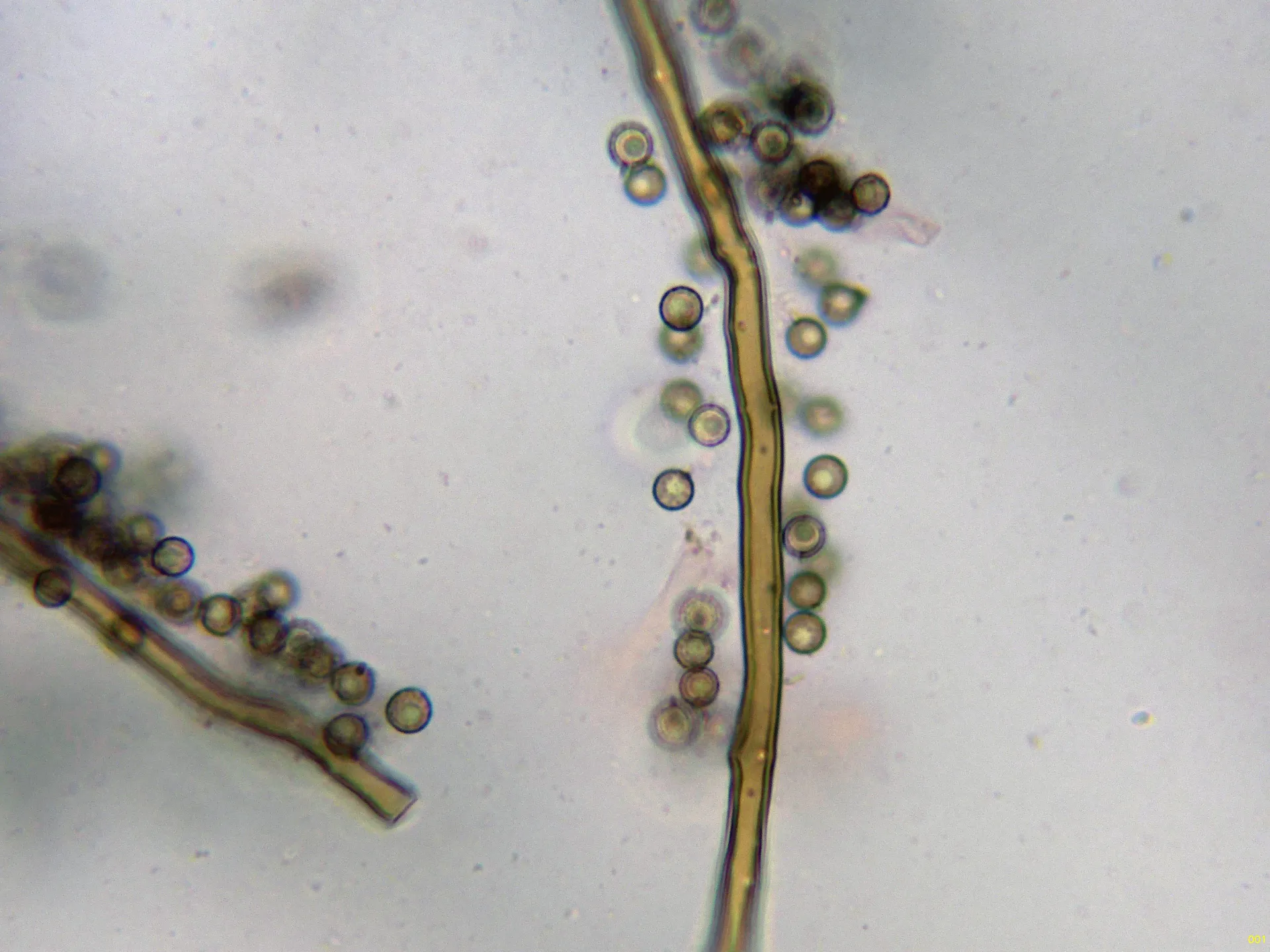 Microscopía de Lycoperdon nigrescens - 5 - Capilicio-001